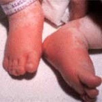 �������� KAWASAKI (7).jpg